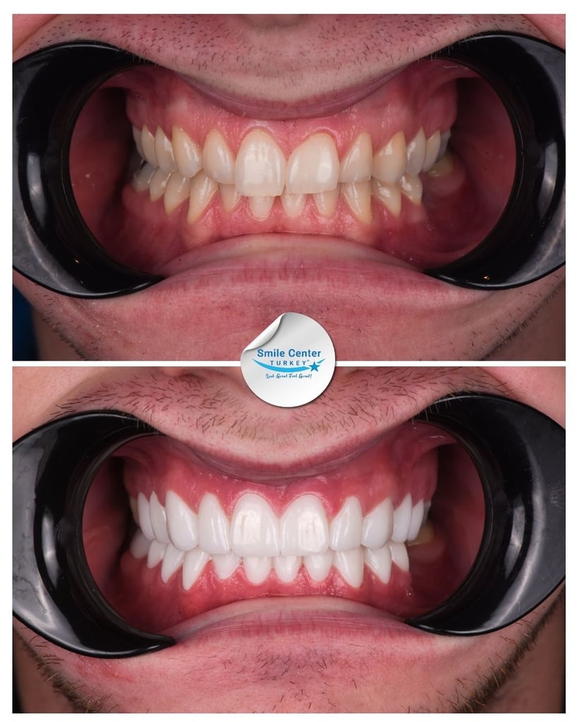 Orrin M. - Centro del Sorriso Turchia