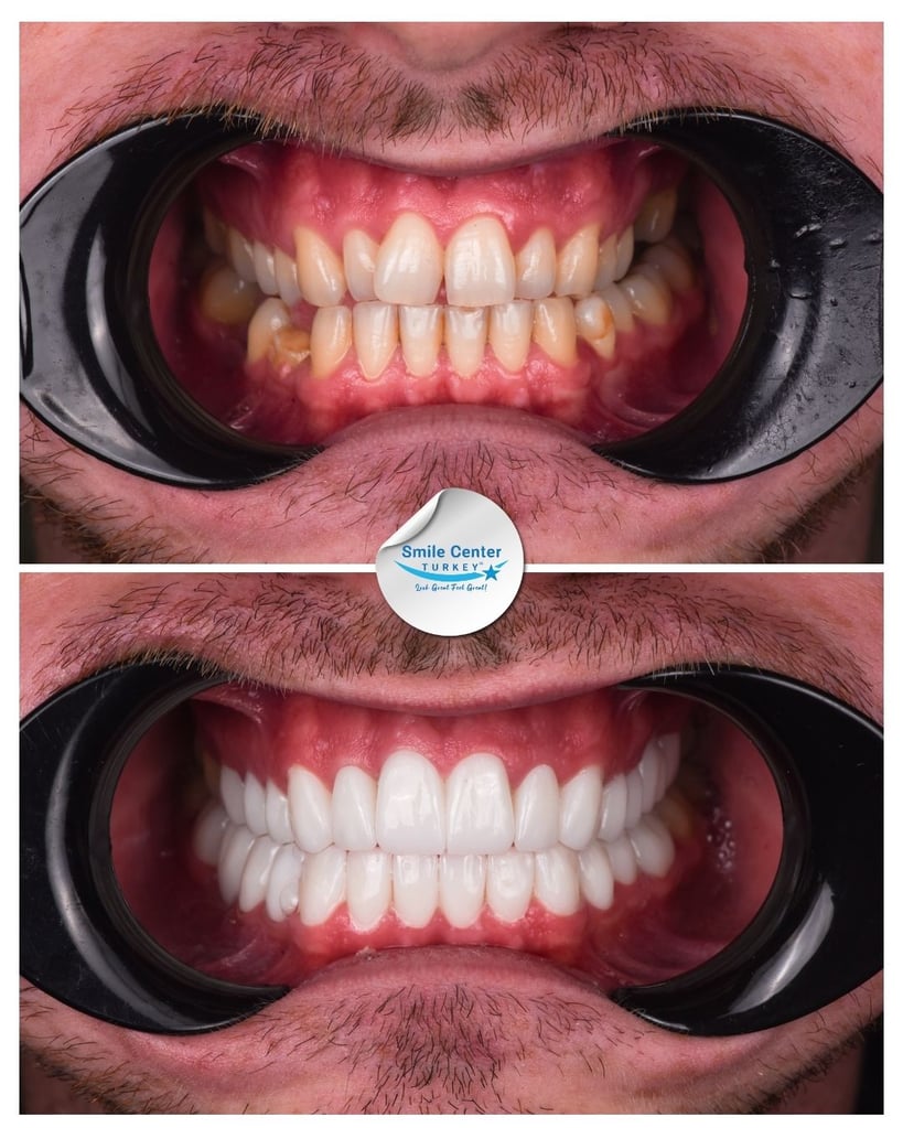 David M. - Centro del sorriso Turchia