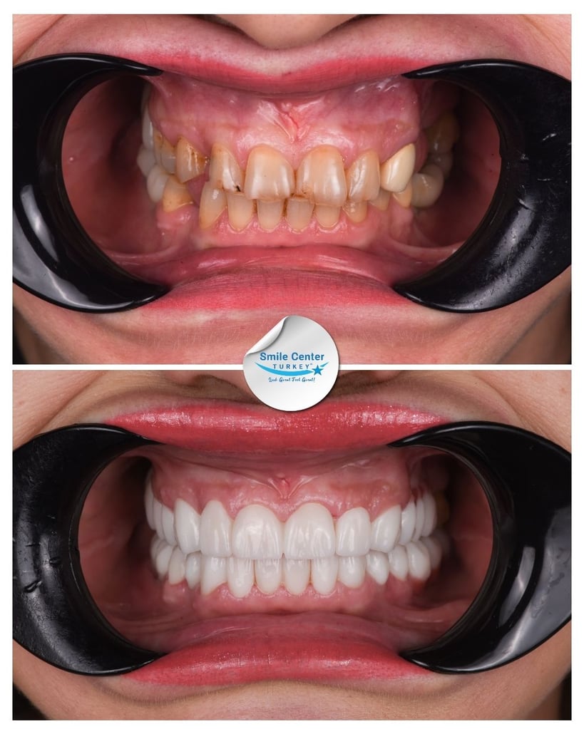 Nicolae S. – Smile Center Turkey®