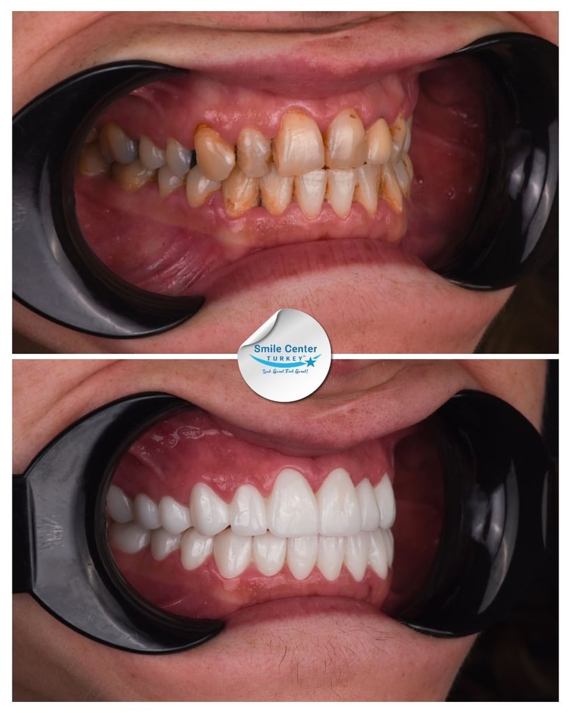 Rioni S. - Centro del Sorriso Turchia