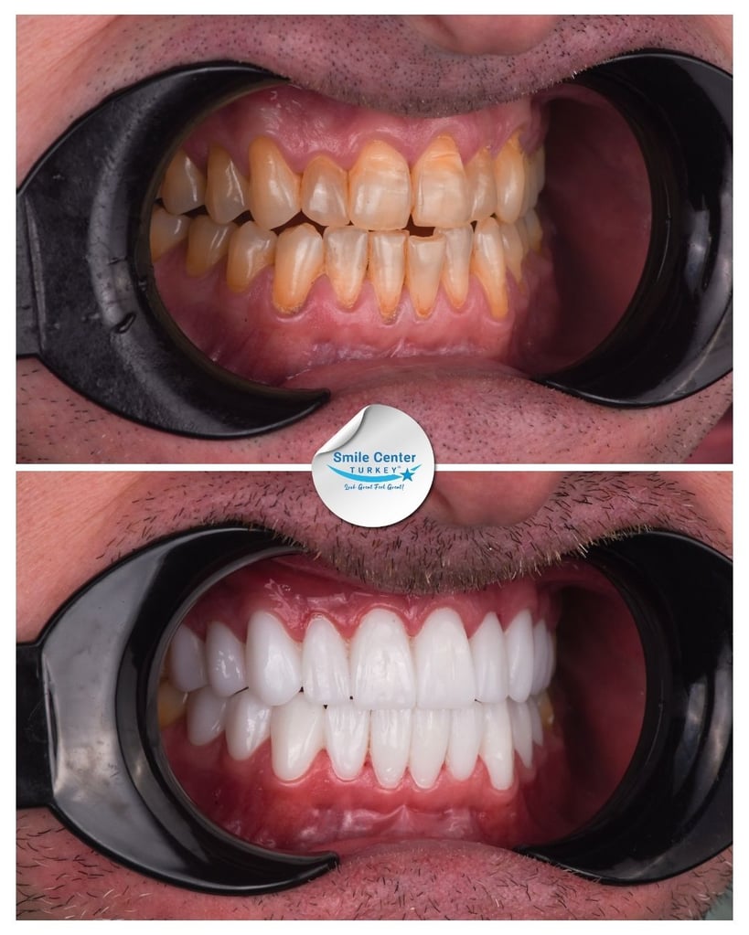 David H. – Smile Center Turkey®
