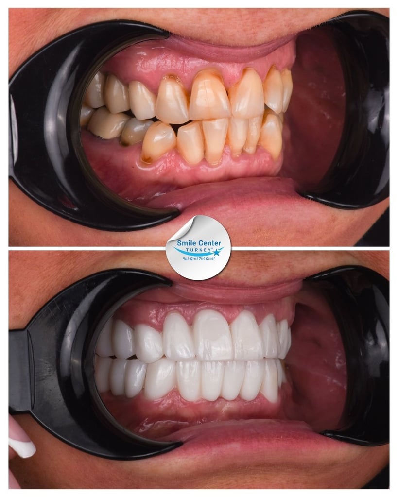 Tatjana L. – Smile Center Turkey®