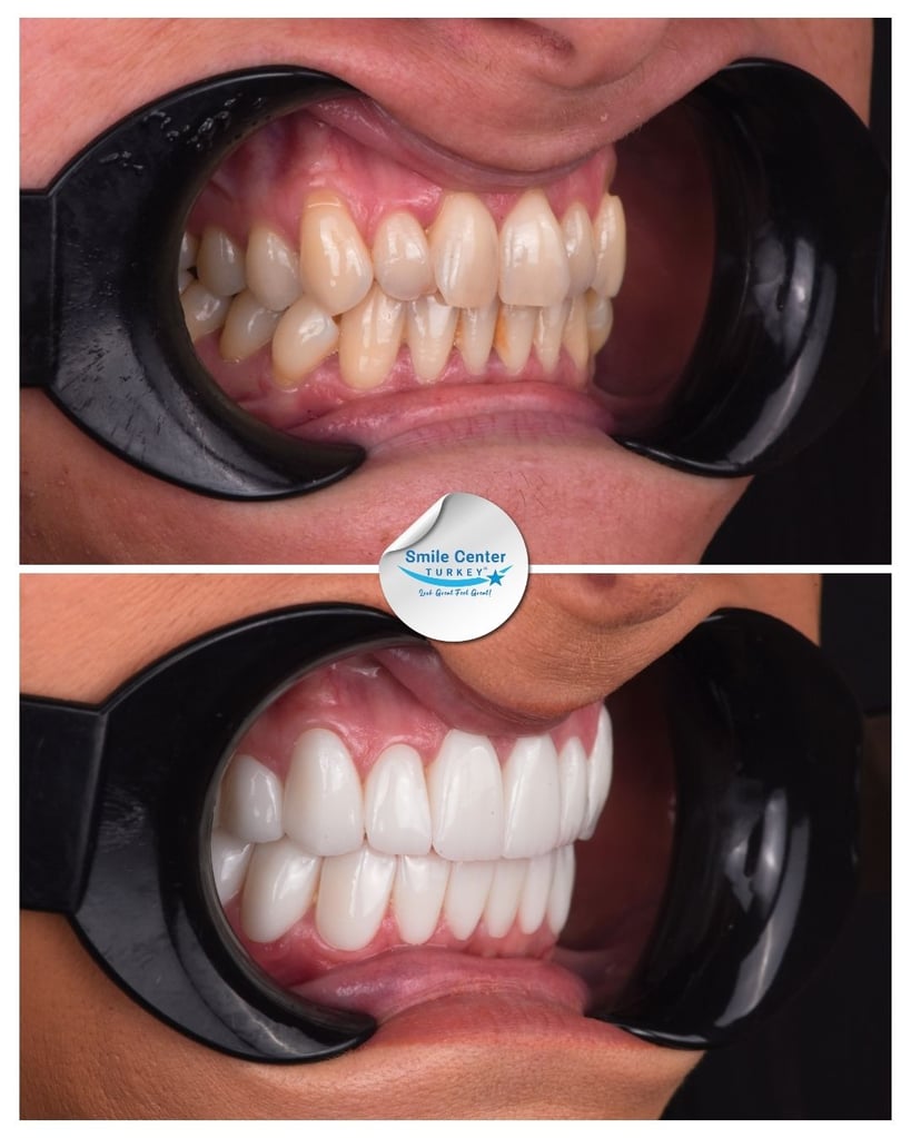 Lauren P. - Centro del sorriso Turchia