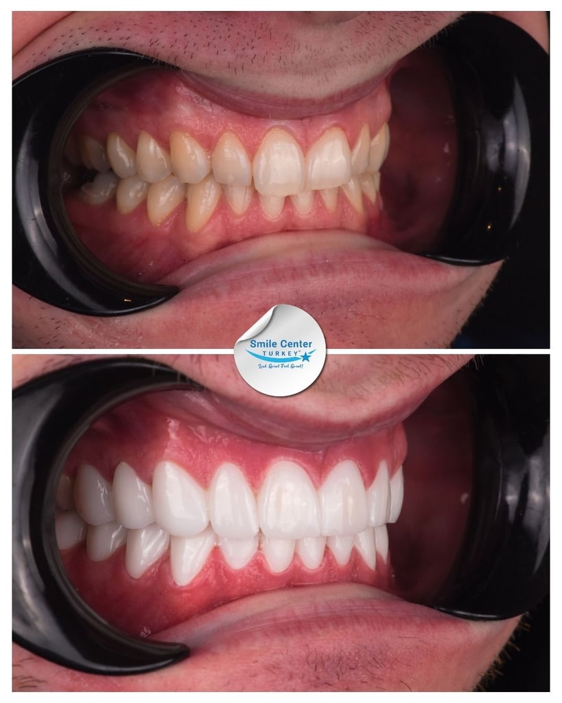 Orrin M. - Centro del Sorriso Turchia