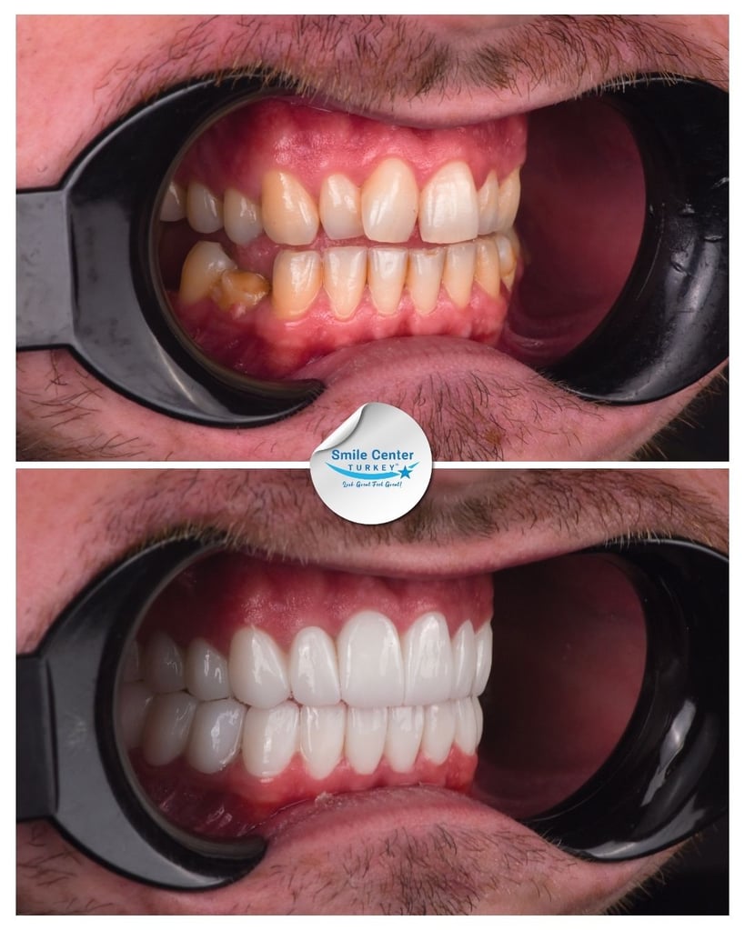 David M. - Centro del sorriso Turchia