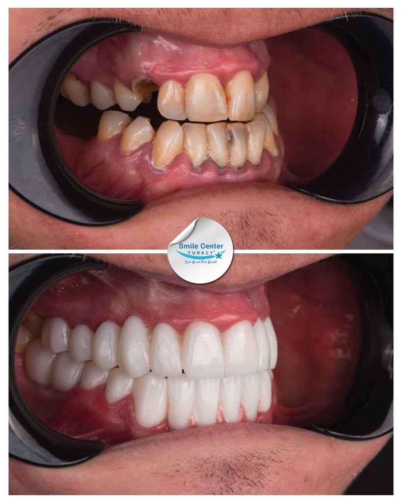 Aivaras V. - Centro del sorriso Turchia