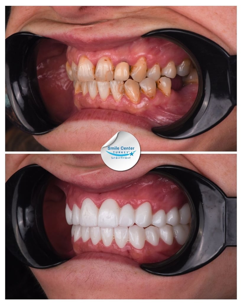 Rioni S. - Centro del Sorriso Turchia