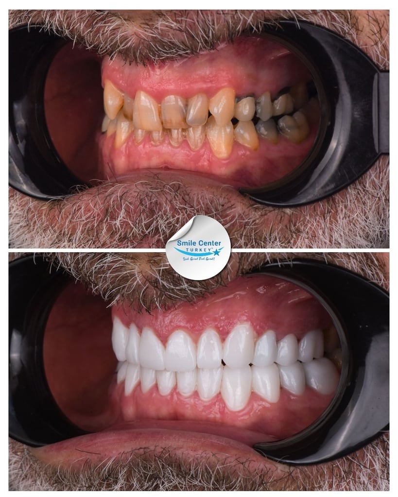 Nicholas K. – Smile Center Turkey®