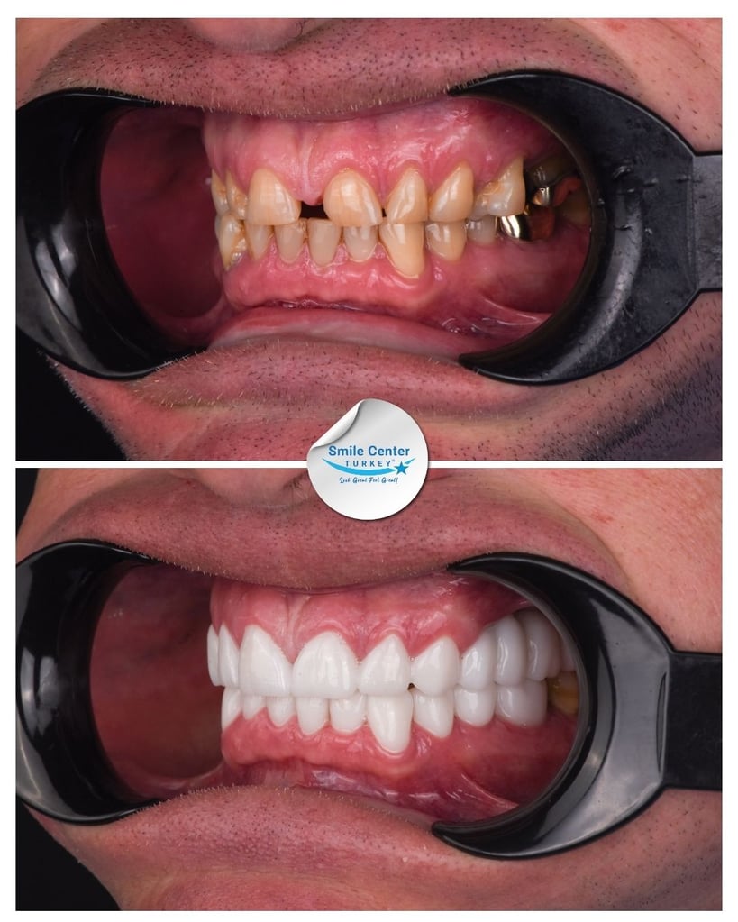 Dwayne O. – Smile Center Turkey®