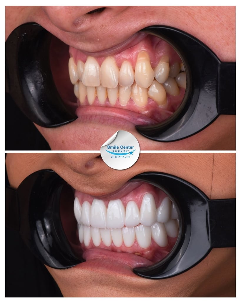 Lauren P. - Centro del sorriso Turchia