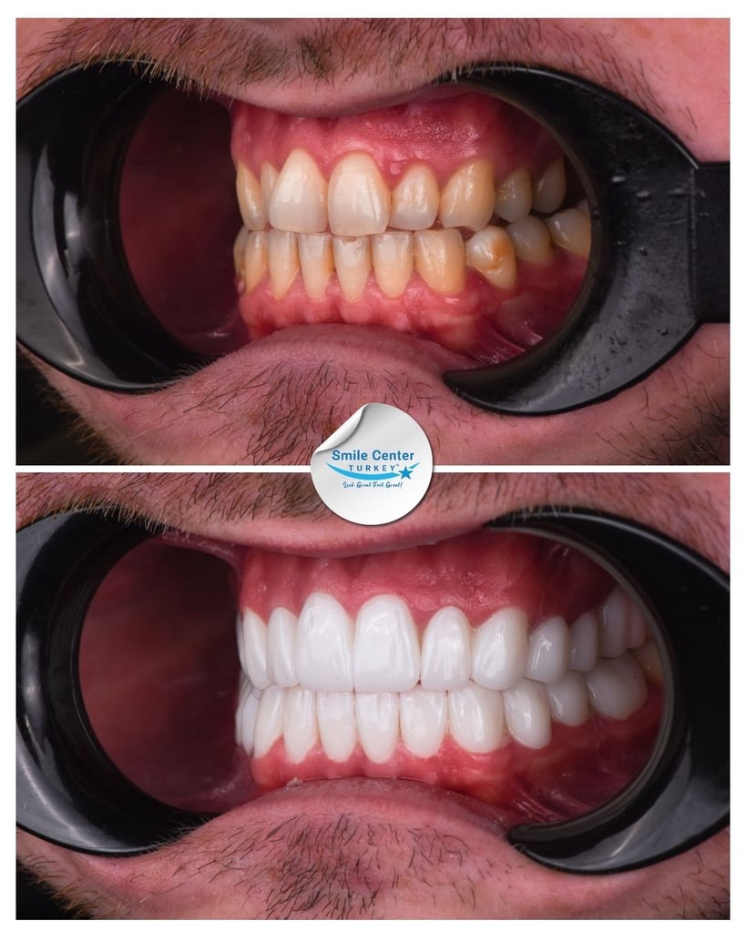 David M. - Centro del sorriso Turchia