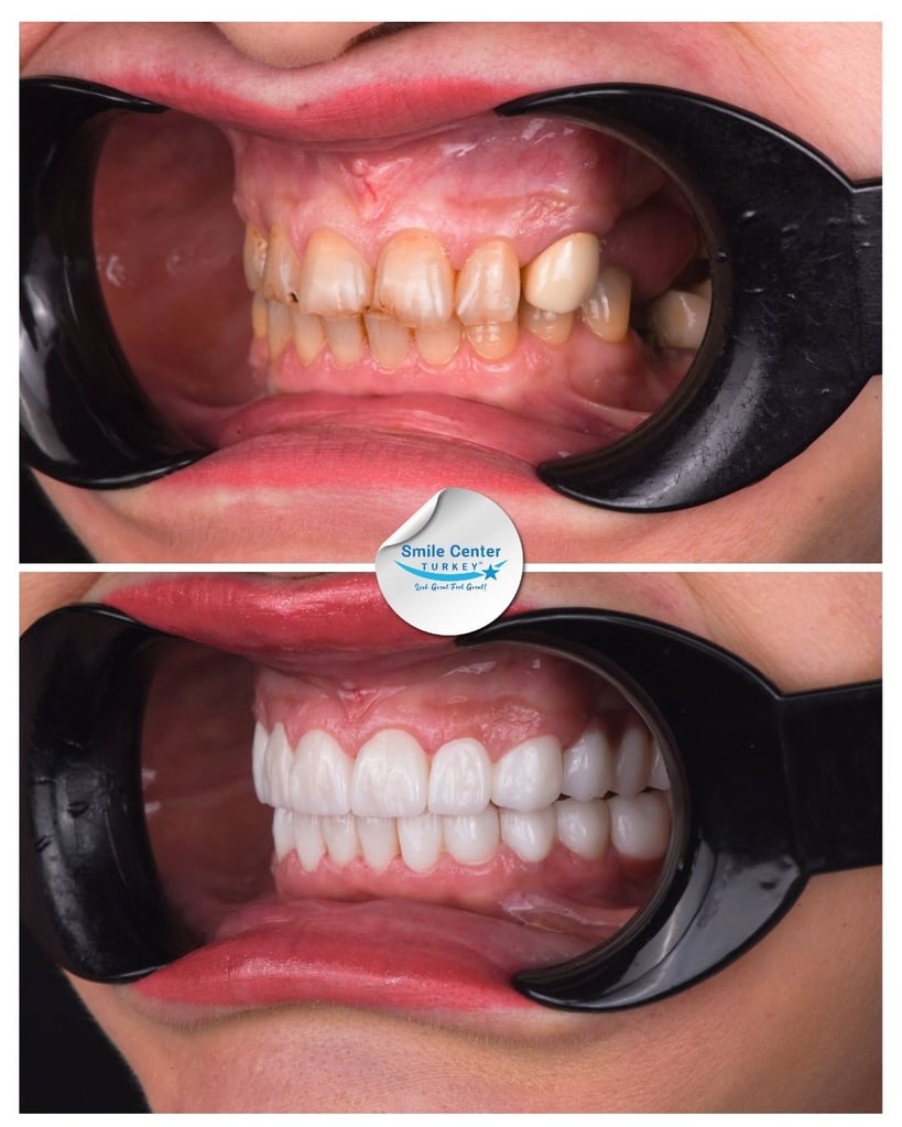 Nicolae S. – Smile Center Turkey®