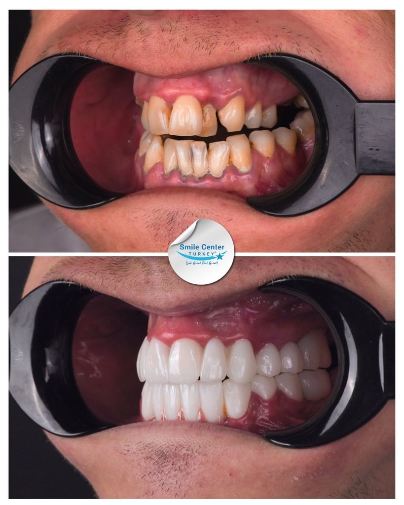 Aivaras V. - Centro del sorriso Turchia