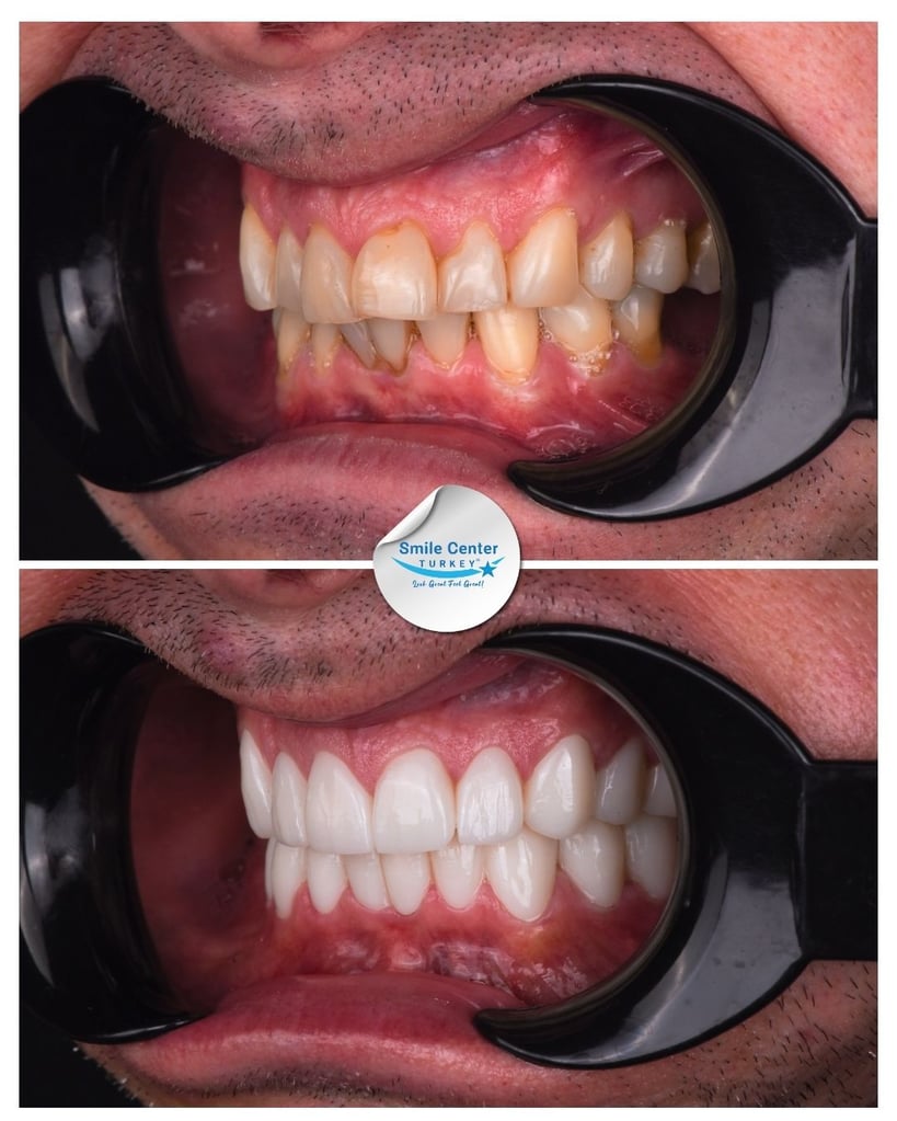 Jason F. – Smile Center Turkey®