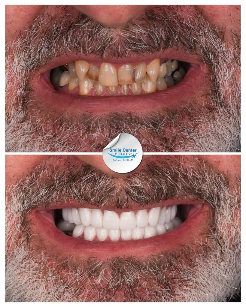Nicholas K. – Smile Center Turkey®