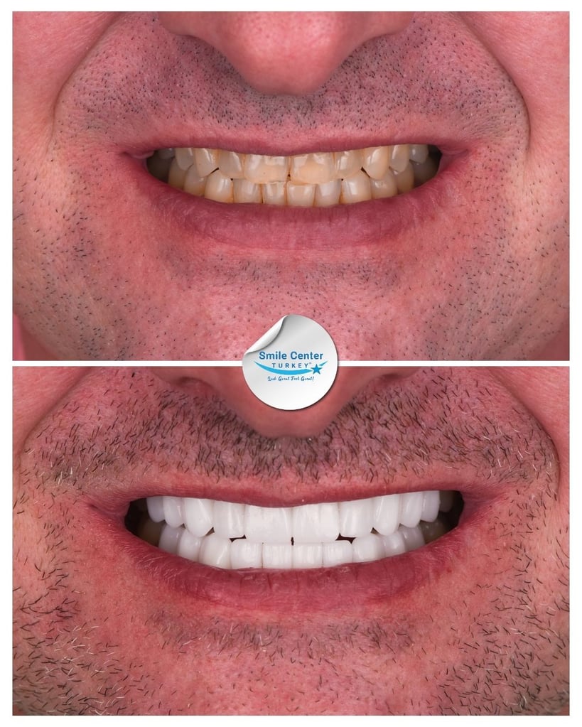 David H. – Smile Center Turkey®