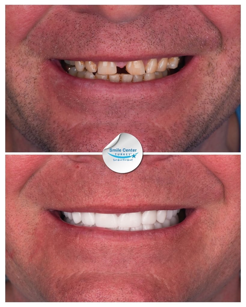 Dwayne O. – Smile Center Turkey®