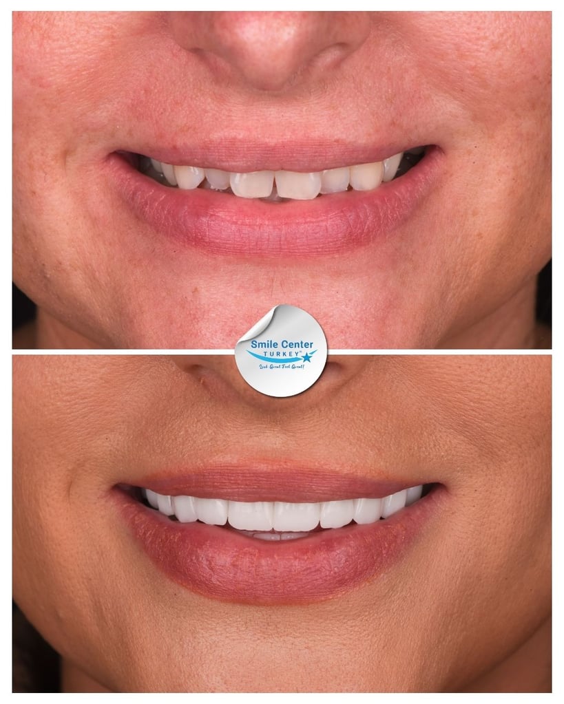 Lauren P. - Centro del sorriso Turchia