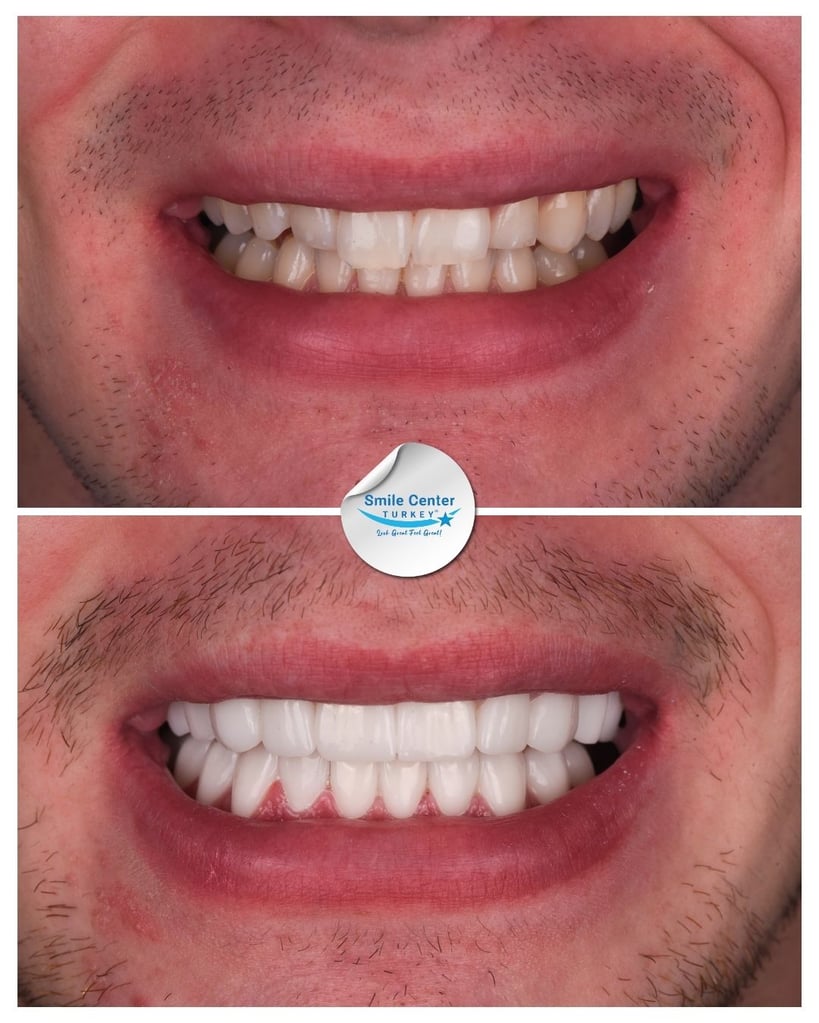 Orrin M. - Centro del Sorriso Turchia