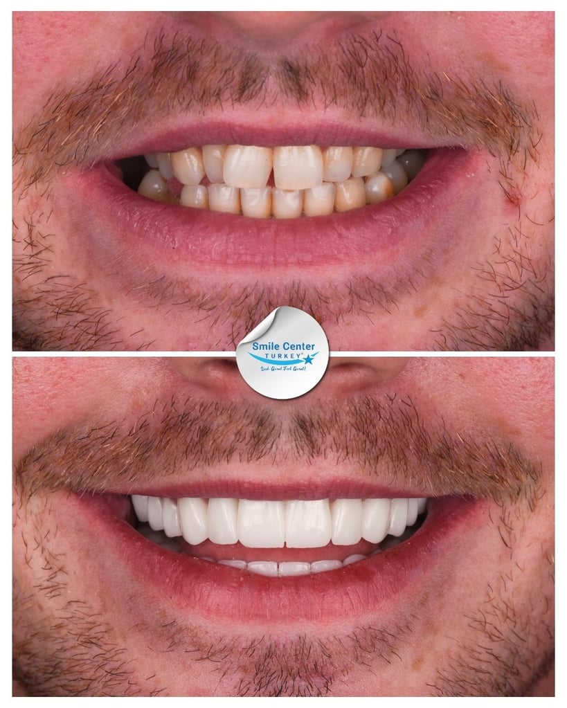 David M. - Centro del sorriso Turchia