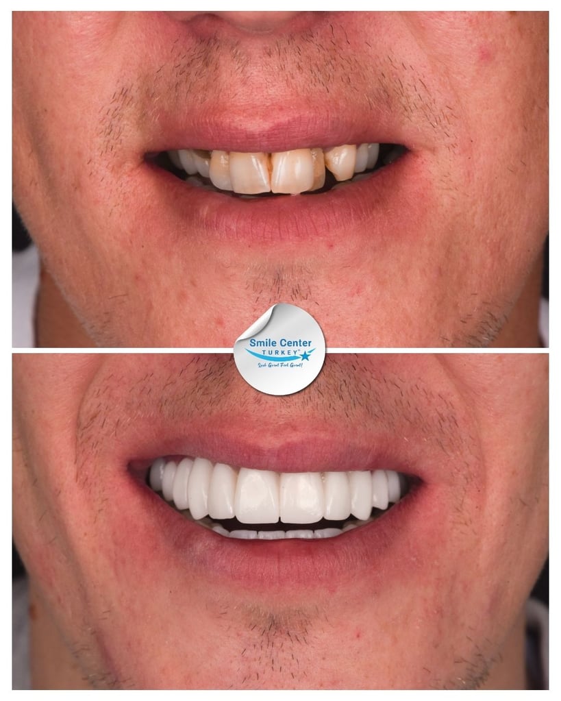 Aivaras V. - Centro del sorriso Turchia