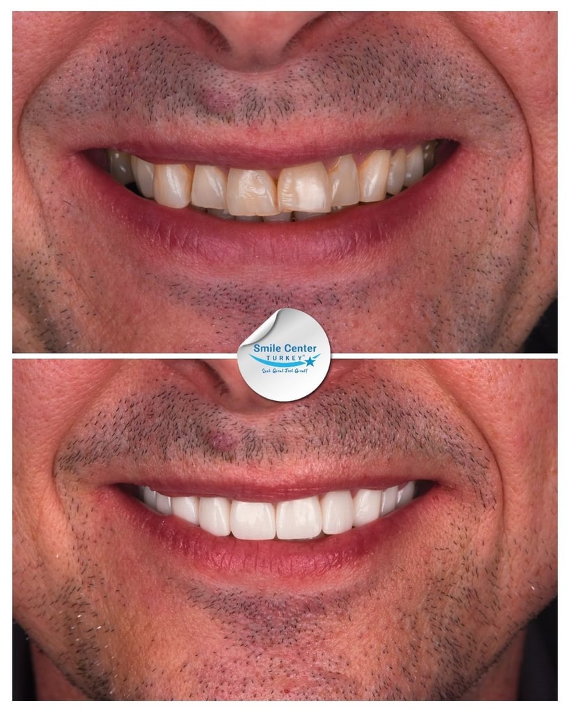 Jason F. – Smile Center Turkey®