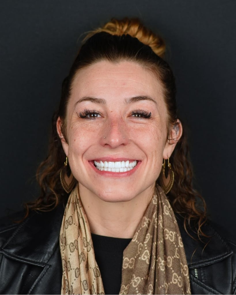 Smile Makeover Gallery – Smile Center Turkey®