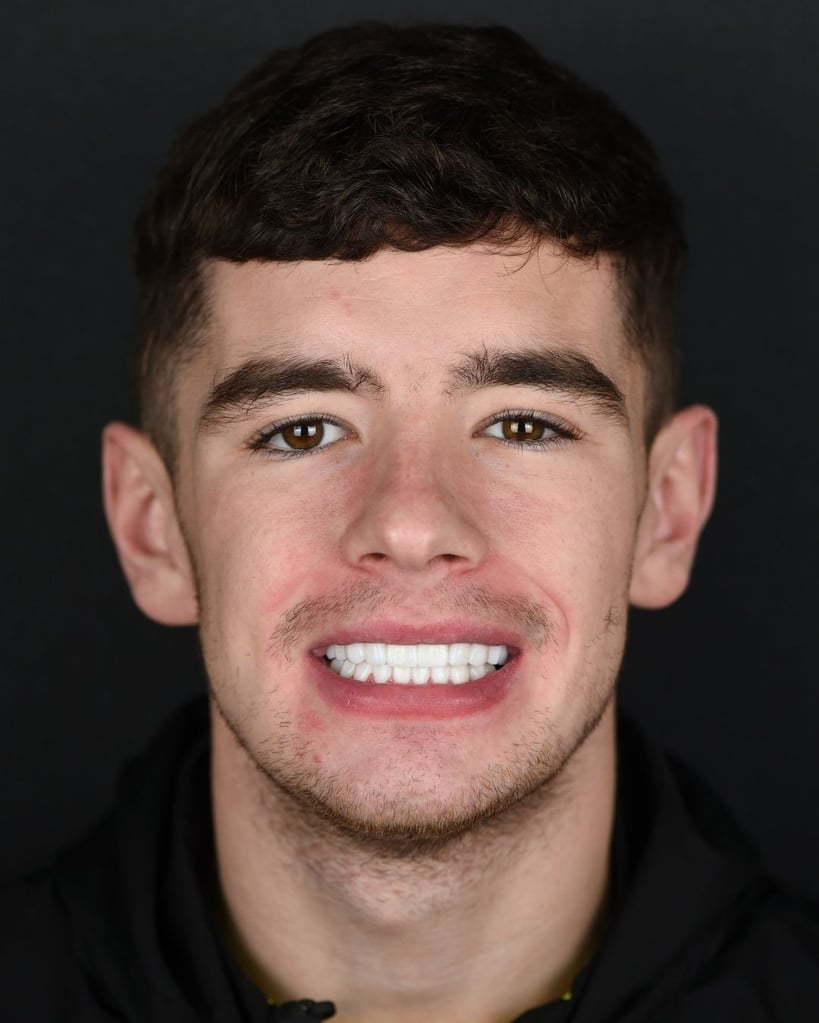 Smile Makeover Gallery – Smile Center Turkey®