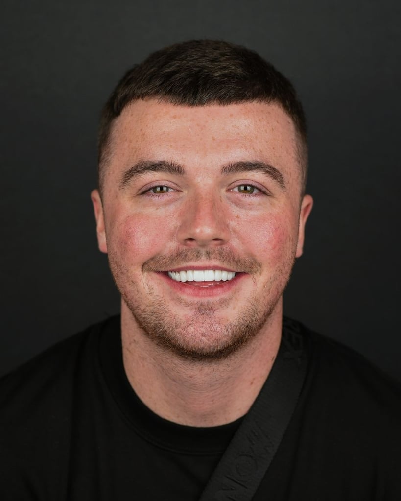 Smile Makeover Gallery – Smile Center Turkey®