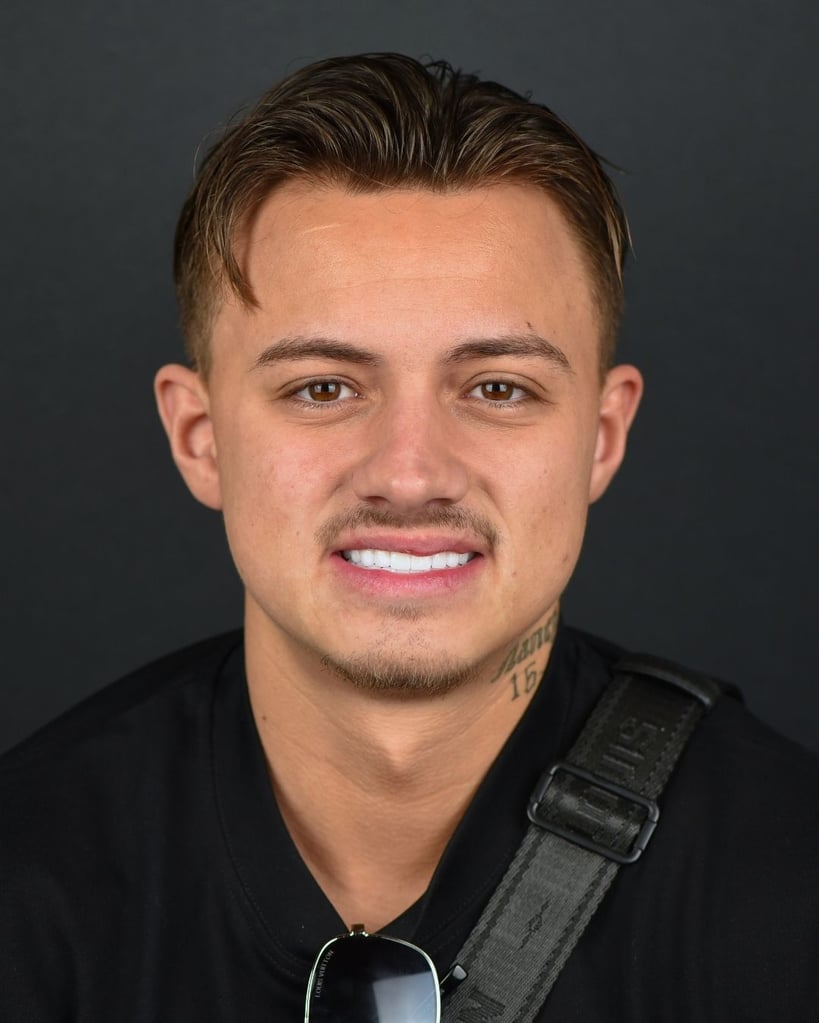 Smile Makeover Gallery – Smile Center Turkey®