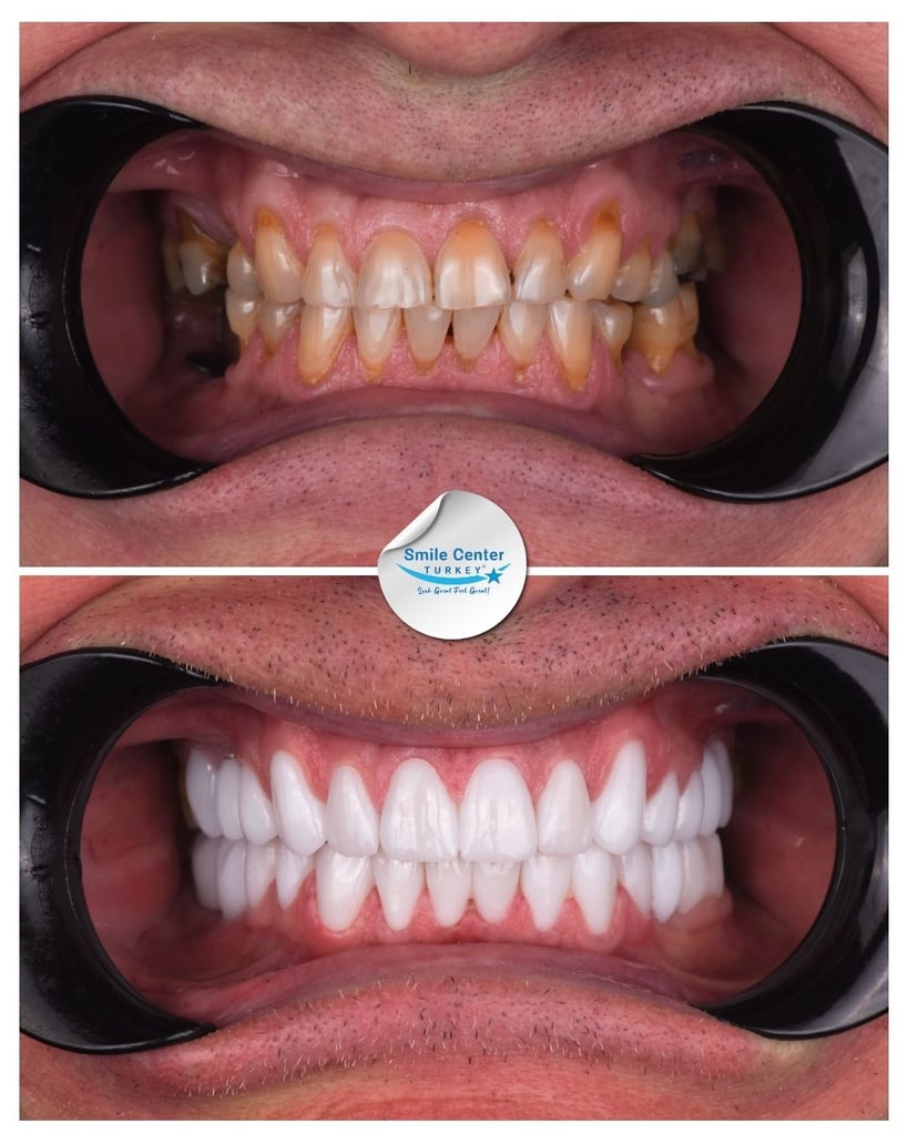 Sergejs A. – Smile Center Turkey®