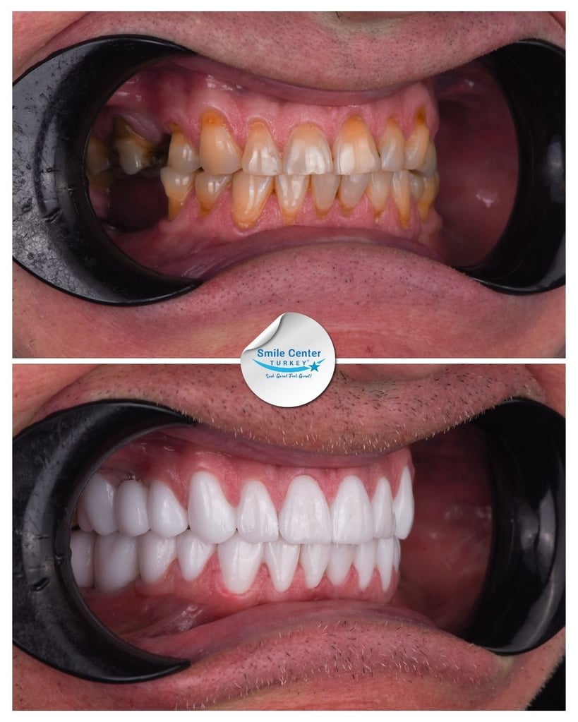 Sergejs A. – Smile Center Turkey®
