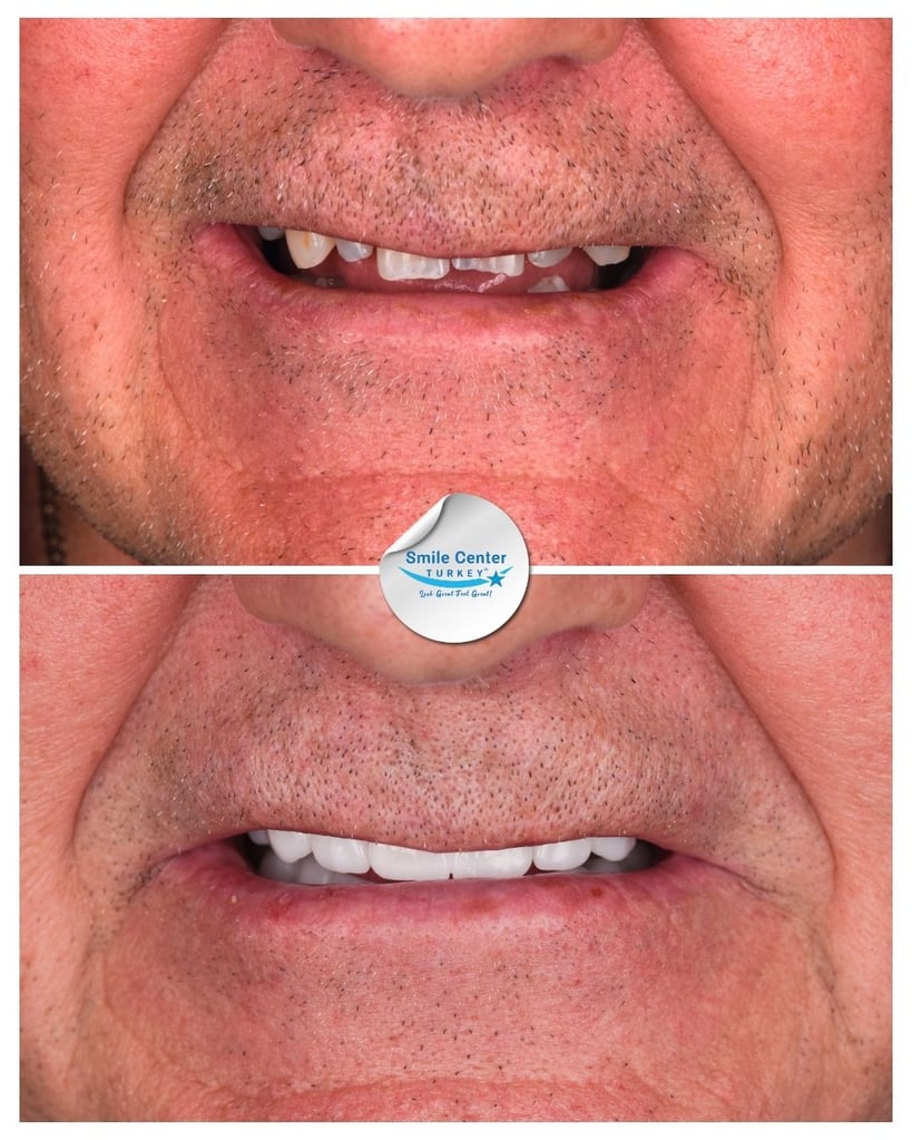 John K. – Smile Center Turkey®