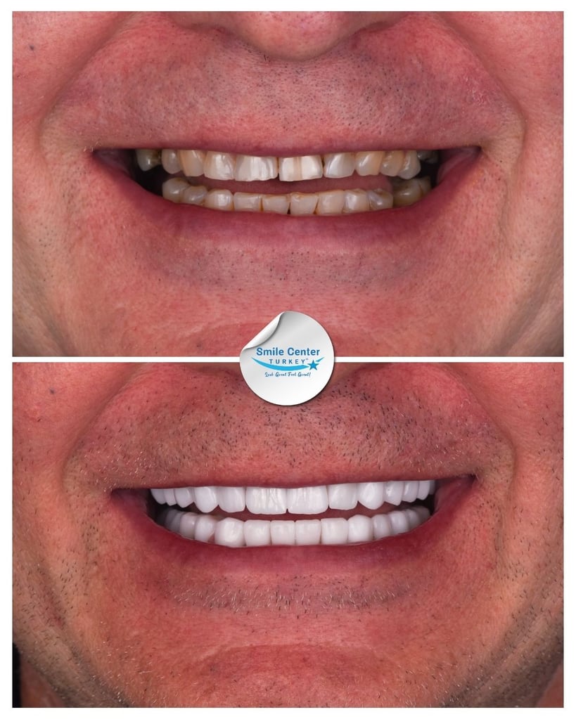 Sergejs A. – Smile Center Turkey®