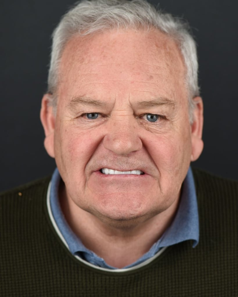 Smile Makeover Gallery – Smile Center Turkey®