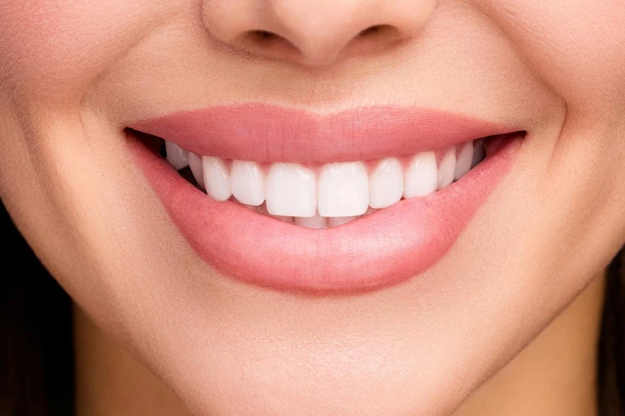 Close-up of perfect white teeth after Hollywood Smile treatment in Turkey