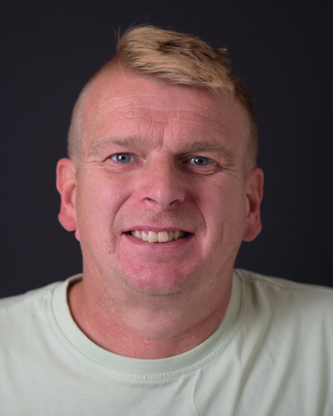 Brett – Smile Center Turkey®