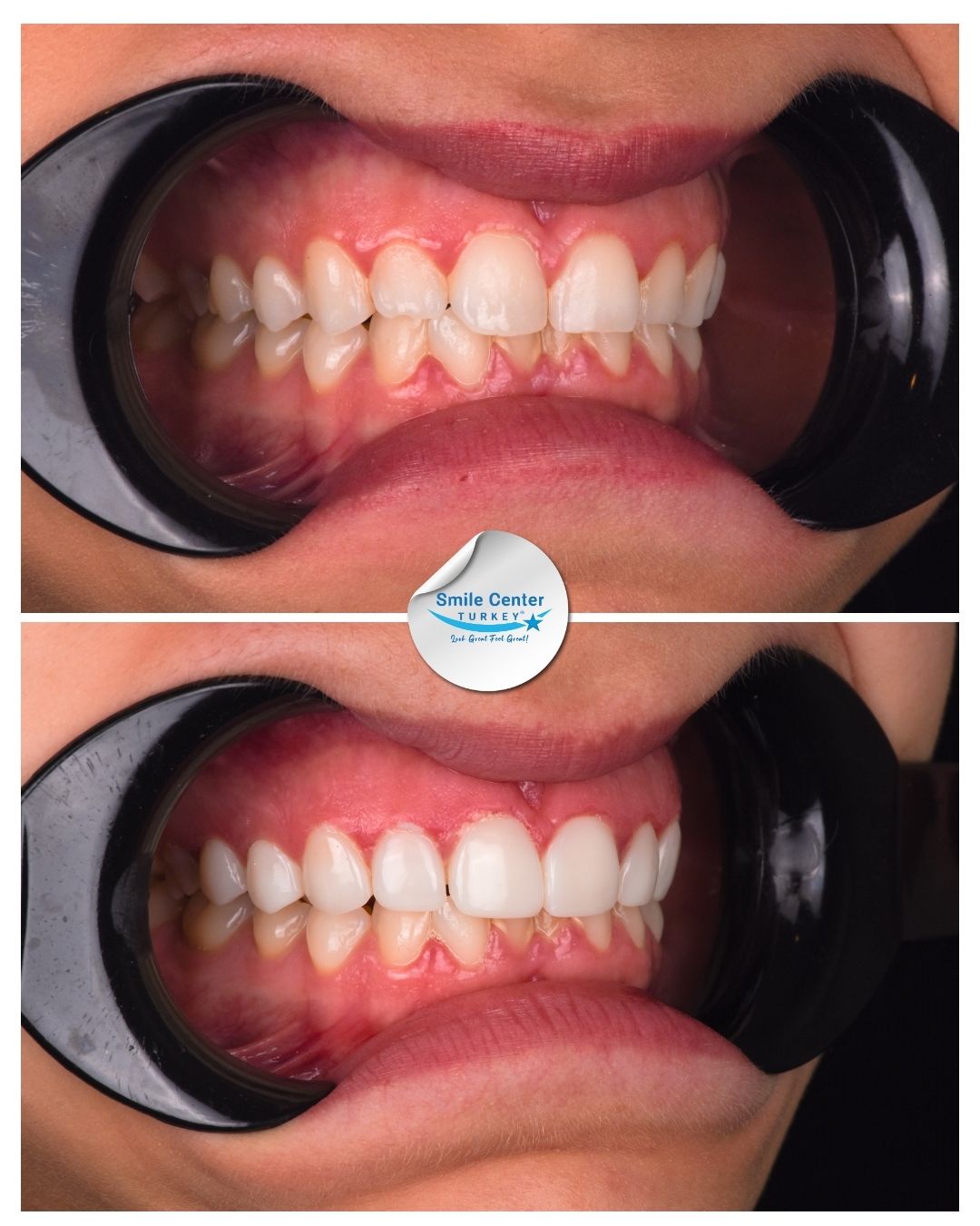 Brooklyn – Smile Center Turkey®