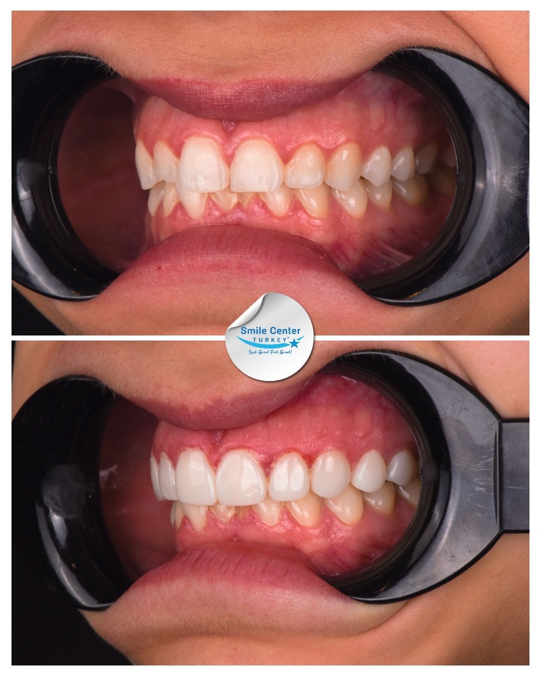 Brooklyn – Smile Center Turkey®