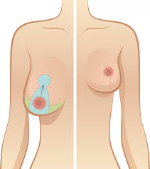 images (1)