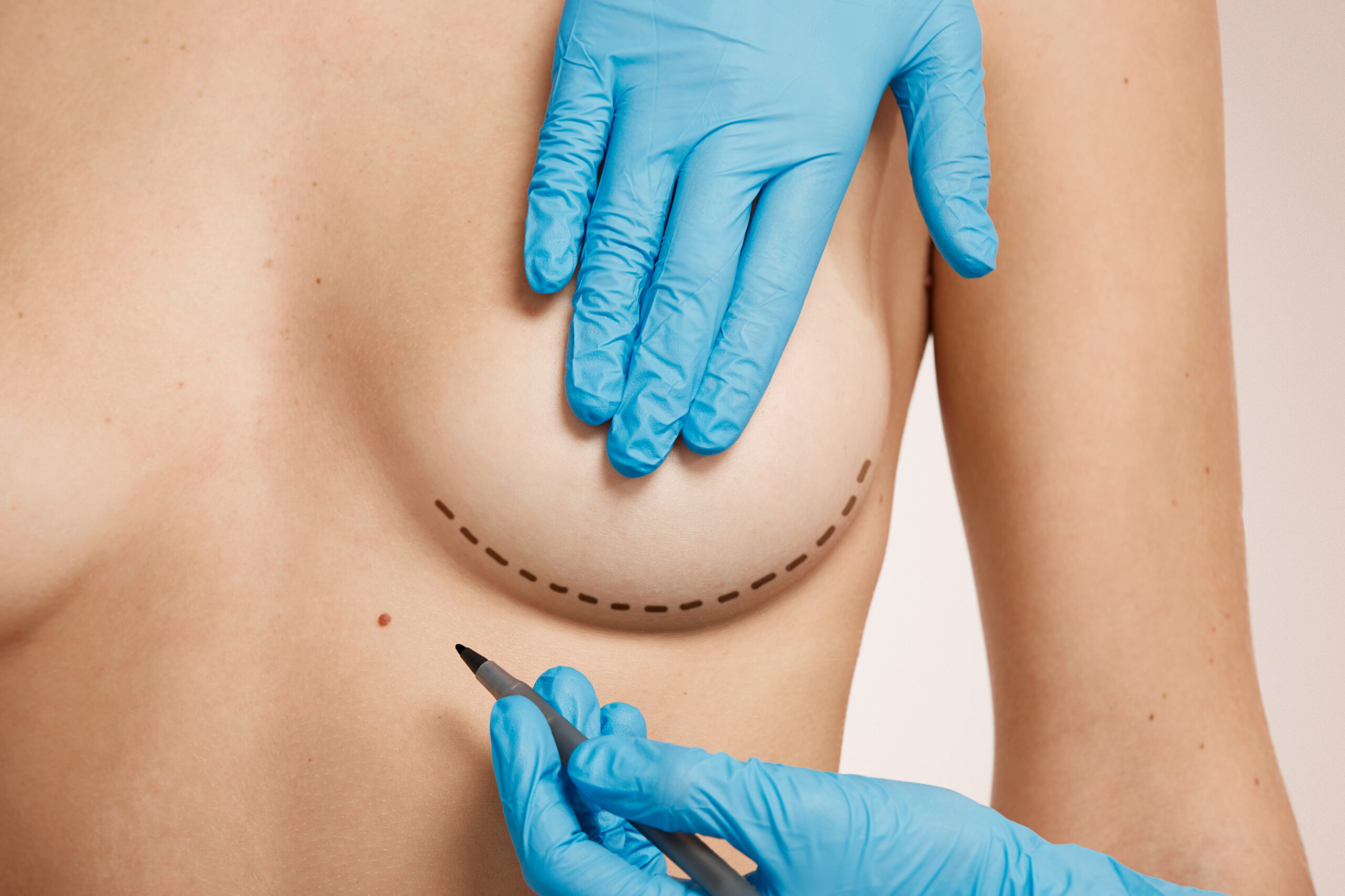 Beautiful woman with plastic surgery, depiction, plastic surgeon hands