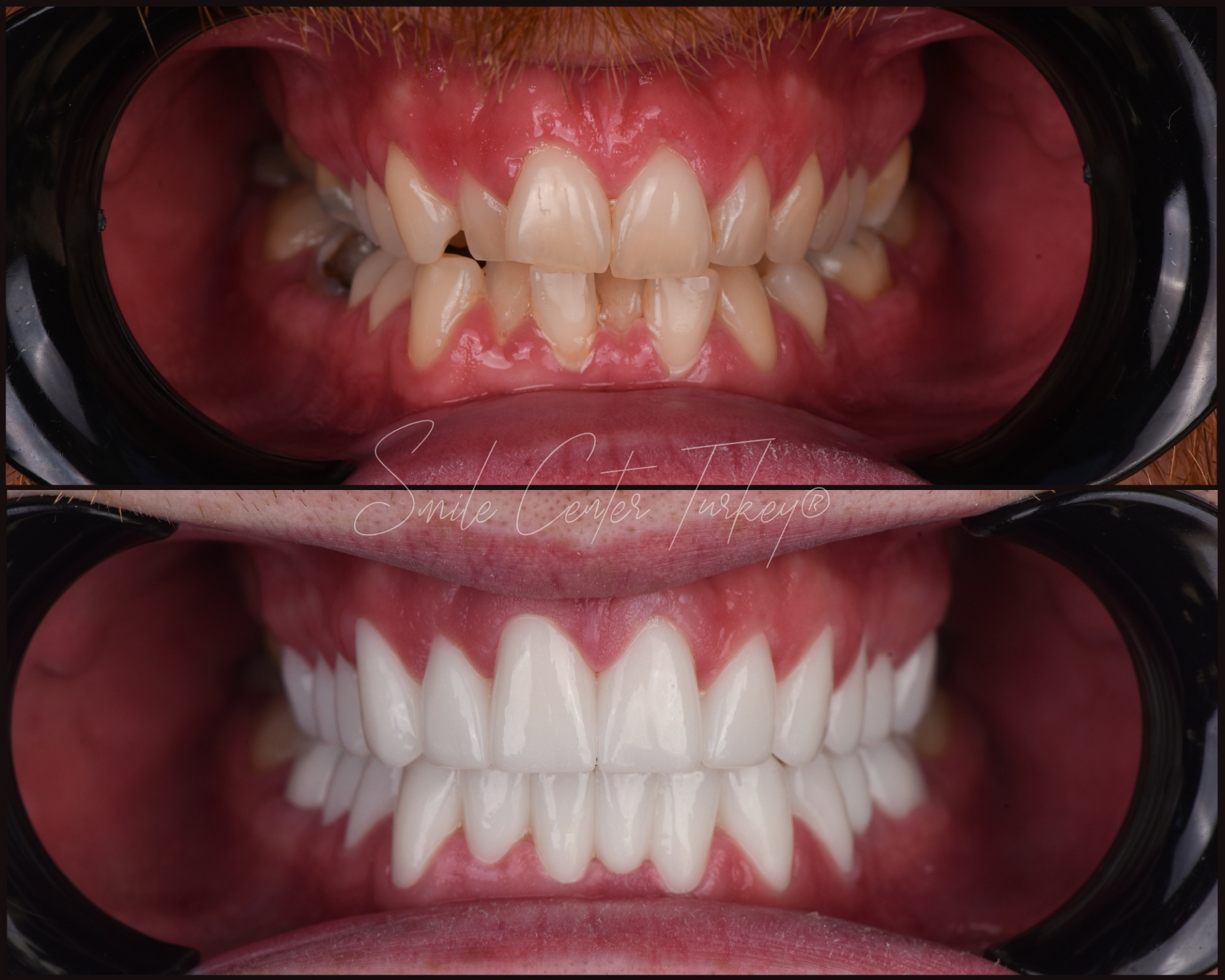 Jordann – Smile Center Turkey®