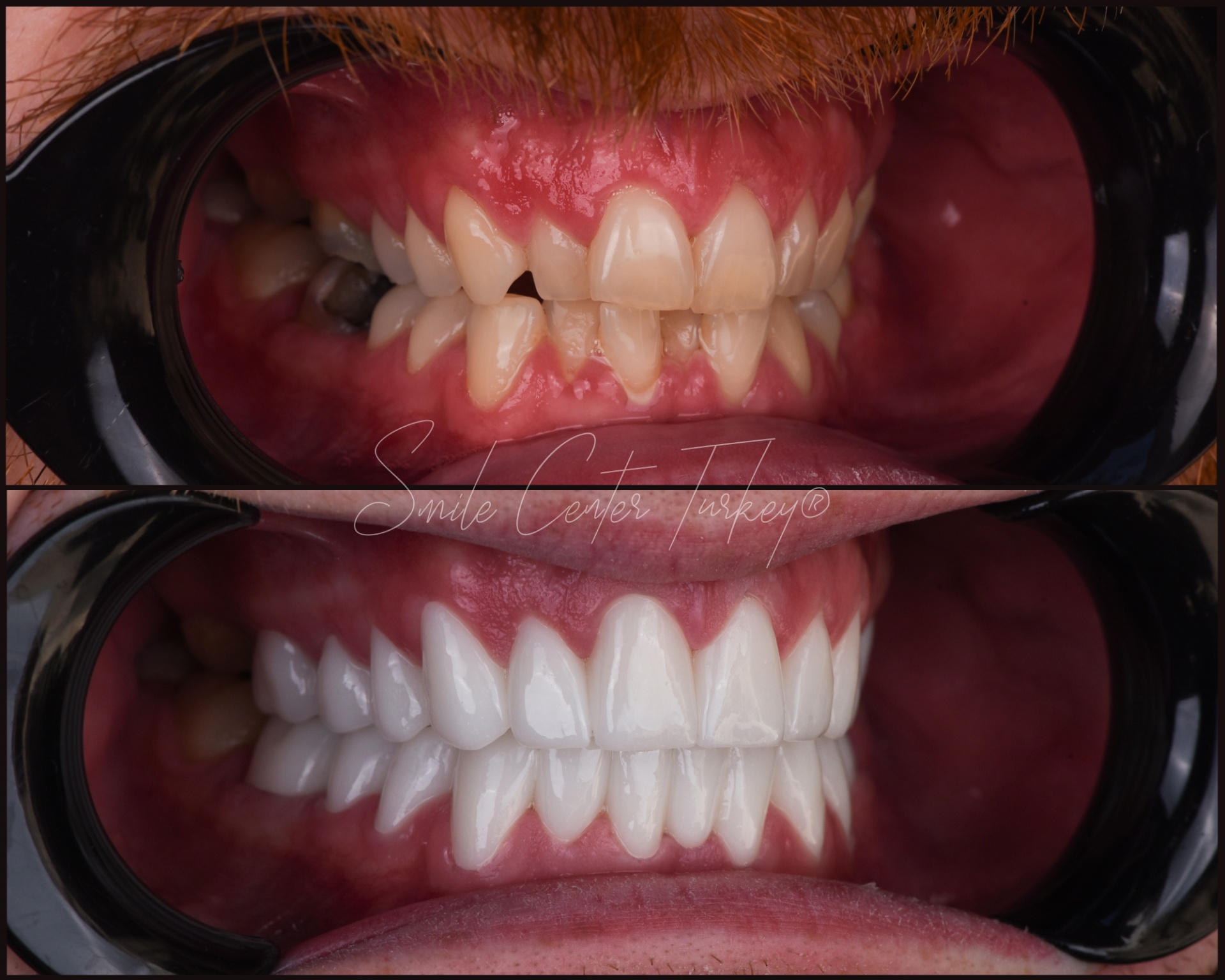 Jordann – Smile Center Turkey®