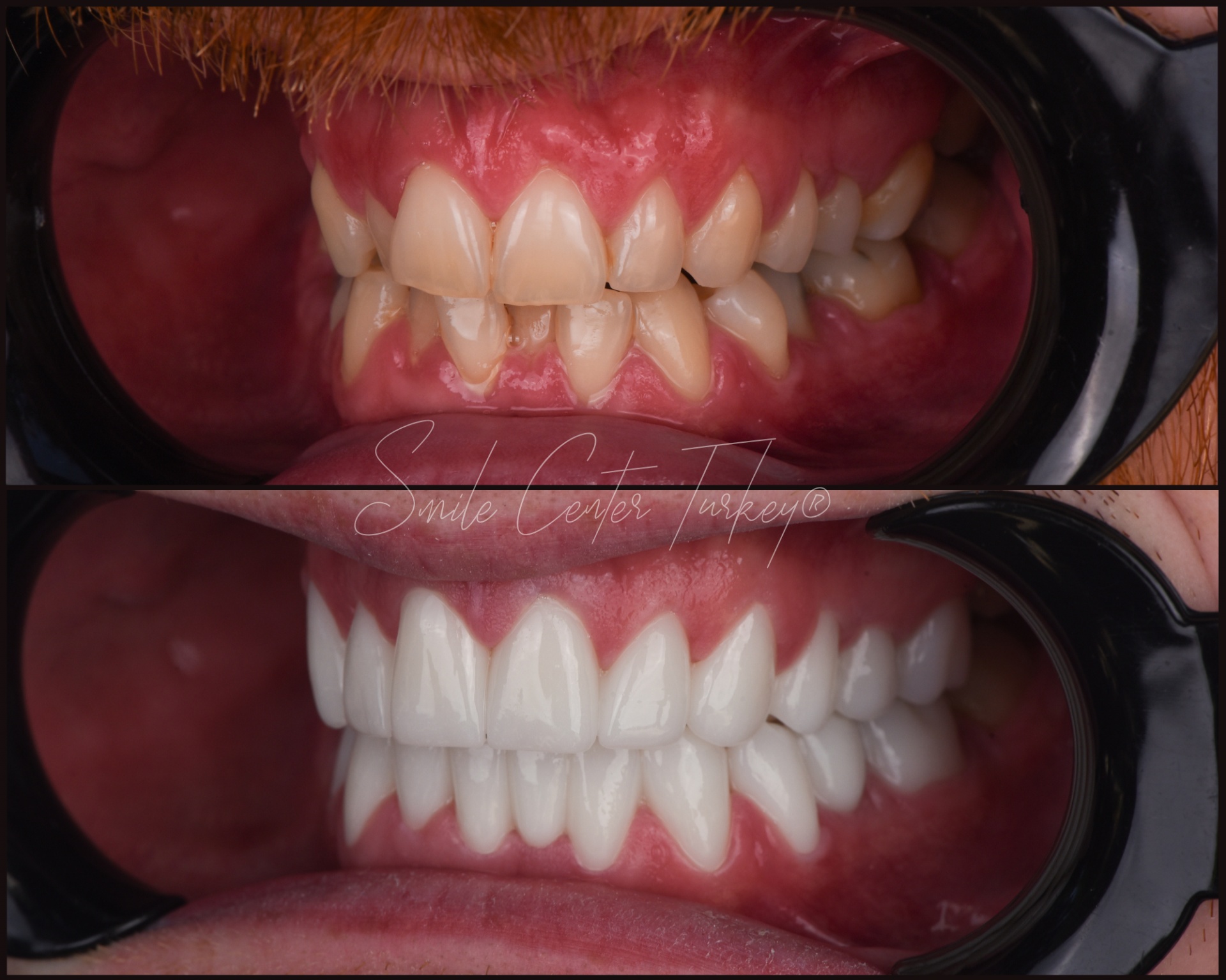 Jordann – Smile Center Turkey®