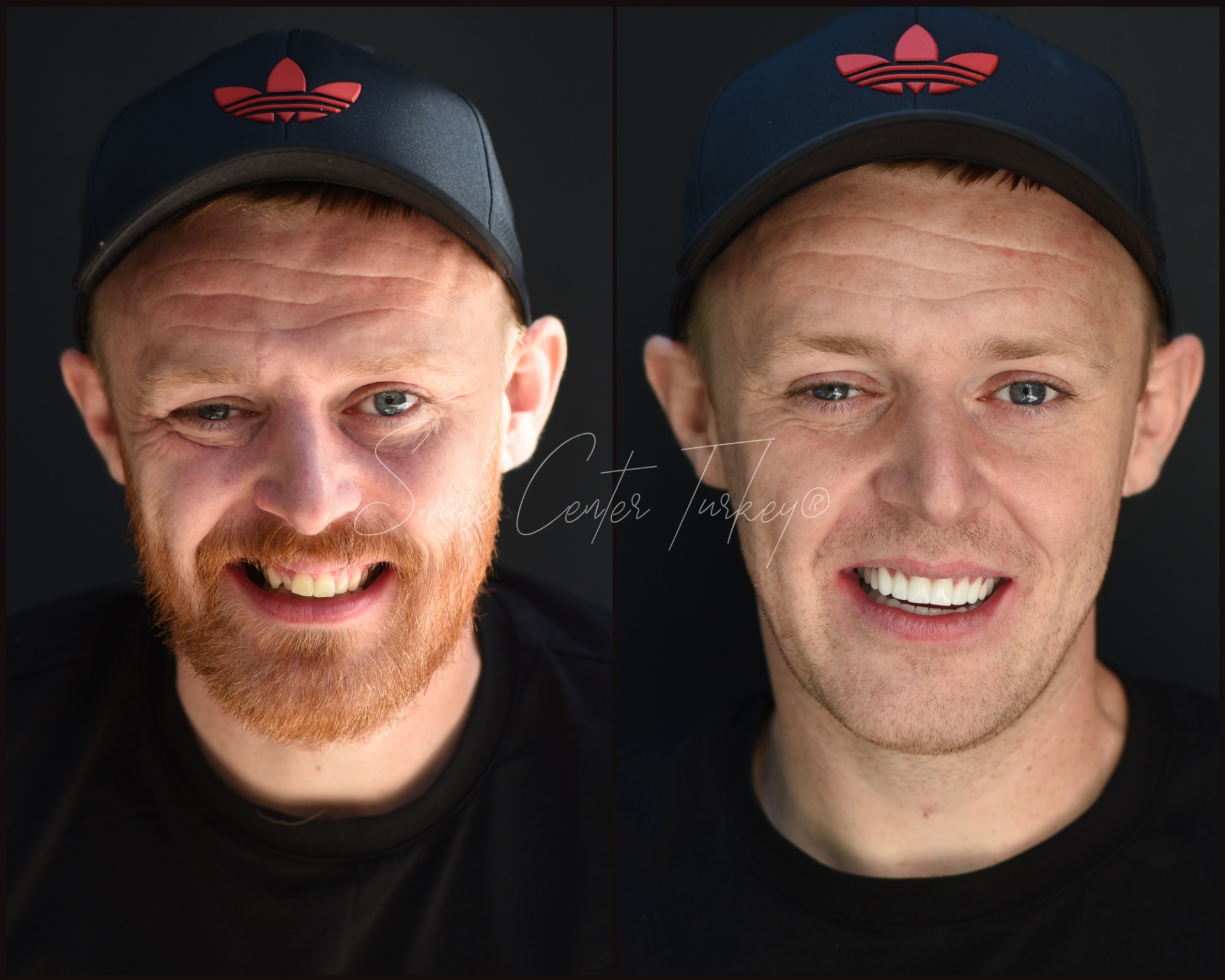 Jordann – Smile Center Turkey®