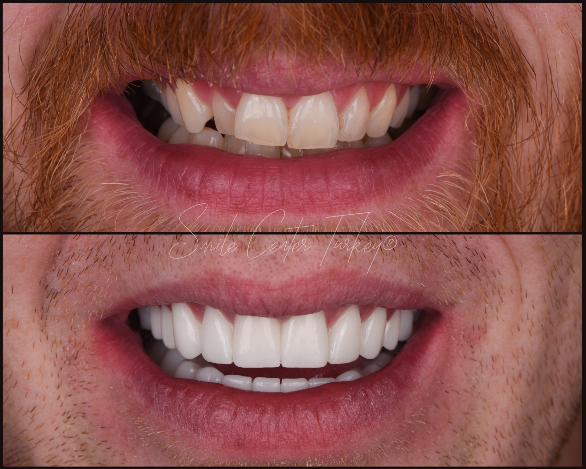 Jordann – Smile Center Turkey®