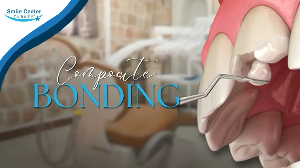 Composite bonding cover image for cosmetic tooth bonding in Antalya Turkey | Smile Center Turkey