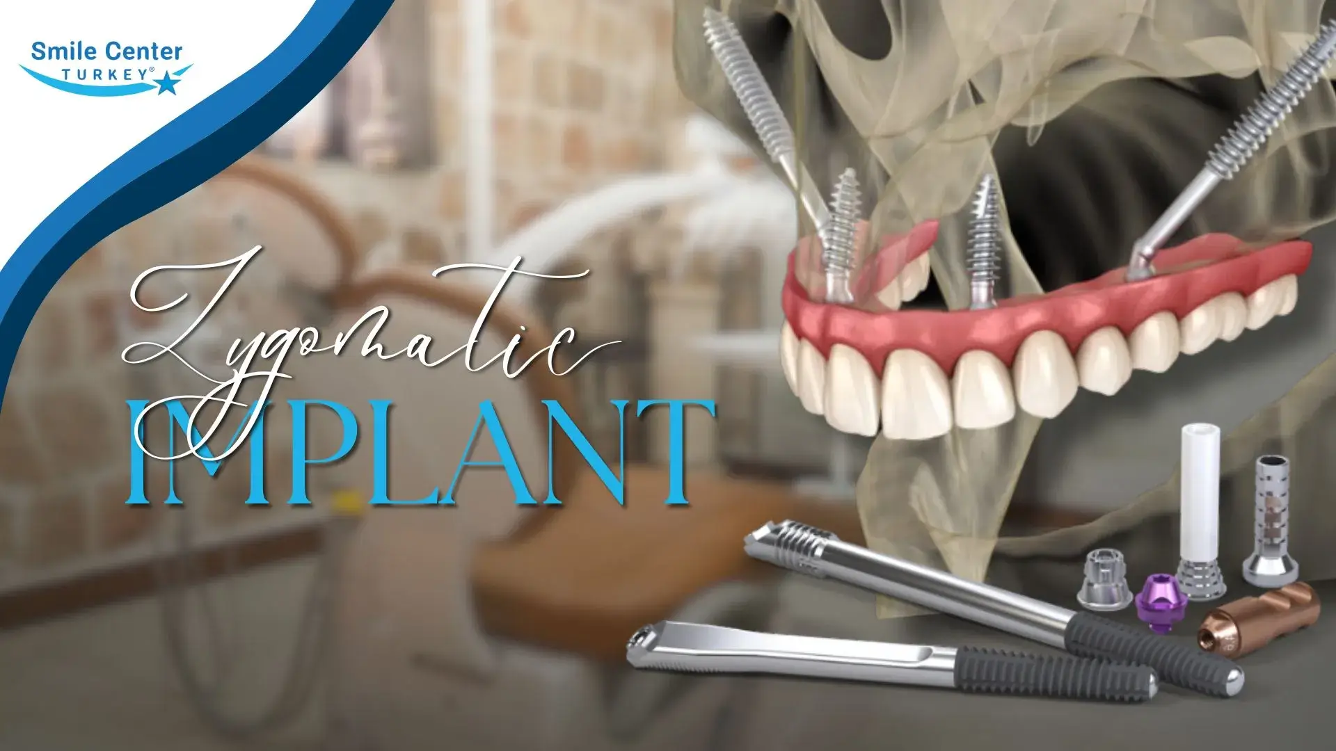 Zygomatic dental implants cover image for All-on-4 full arch restoration in Antalya | Smile Center Turkey